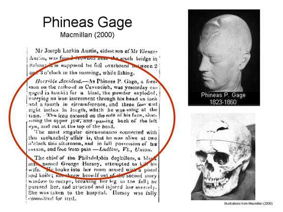 Phineas Gage » Stuff4Educators.com